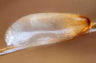 remove lice eggs from hair